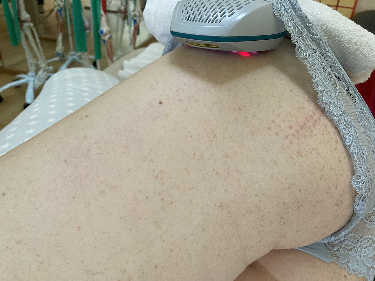 Low Level Lasertherapie